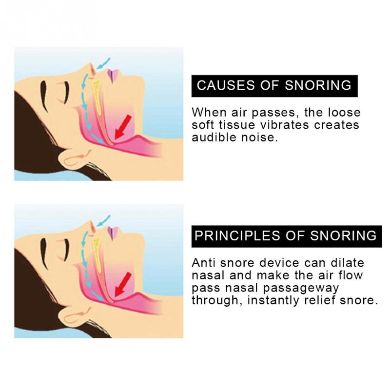 Upgraded Anti-Snore Nose Purifier Stopper Device